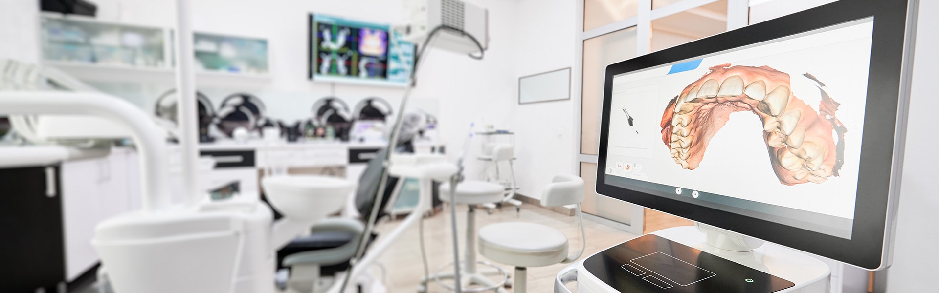 Send Digital Case - Elite Dental Lab